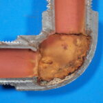 サムネイル：抜管写真