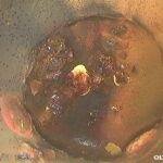 サムネイル：給水管内劣化